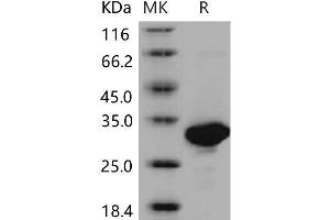 Western Blotting (WB) image for Carbonic Anhydrase II (CA2) (Active) protein (His tag) (ABIN7194562) (CA2 Protein (His tag))