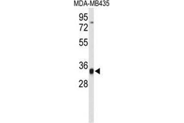 TFPT antibody  (N-Term)
