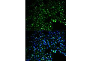 Immunofluorescence analysis of HeLa cells using UGDH antibody. (UGDH antibody  (AA 165-494))