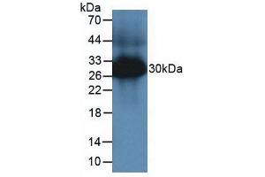 Western blot analysis of Mouse Large Intestine Tissue. (TPSAB1 antibody  (AA 149-273))