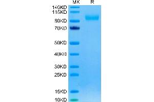 Rhesus macaque EGFR on Tris-Bis PAGE under reduced condition. (EGFR Protein (AA 25-645) (His tag))