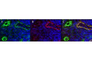 Immunohistochemistry detection of endogenous LYVE-1 in cryo sections of human colon carcinoma using anti-LYVE-1 (human), pAb  (red) and anti-human CD31 pAb (green). (LYVE1 antibody  (AA 24-232))