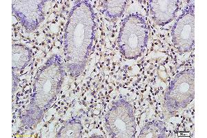 Formalin-fixed and paraffin embedded rat lung tissue labeled with Anti-FBP1 Polyclonal Antibody, Unconjugated (ABIN752053) at 1:200 followed by conjugation to the secondary antibody (FBP1 antibody  (AA 31-130))