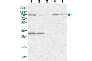 Western blot analysis of Lane 1: RT-4, Lane 2: U-251 MG, Lane 3: Human Plasma, Lane 4: Liver, Lane 5: Tonsil with FCHO2 polyclonal antibody . (FCHO2 antibody)