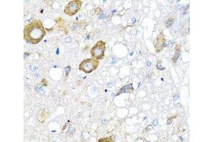 Immunohistochemistry of paraffin-embedded Rat brain using MGP Polyclonal Antibody at dilution of 1:100 (40x lens).