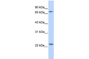 WB Suggested Anti-ZNF185 Antibody Titration:  0. (Zinc Finger Protein 185 antibody  (N-Term))