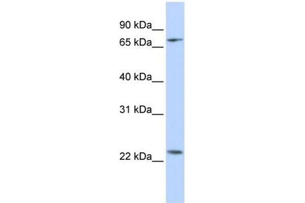 Zinc Finger Protein 185 antibody  (N-Term)