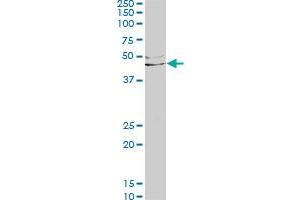 LEFTY1 monoclonal antibody (M03), clone 2E10. (LEFTY1 antibody  (AA 1-366))