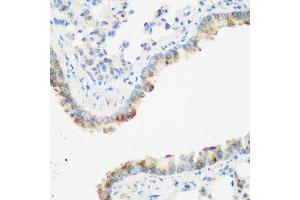 Immunohistochemistry of paraffin-embedded mouse lung using IGF2BP3 antibody at dilution of 1:200 (40x lens). (IGF2BP3 antibody)