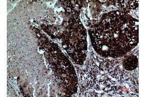 Immunohistochemistry (IHC) analysis of paraffin-embedded Human Lung, antibody was diluted at 1:100. (ITGAD antibody  (Internal Region))