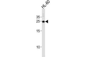 Western Blotting (WB) image for anti-Homeobox A6 (HOXA6) antibody (ABIN2996495)