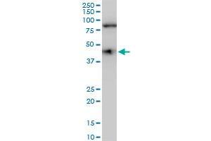 COPS3 polyclonal antibody (A01), Lot # 060113JC01. (COPS3 antibody  (AA 324-422))