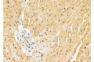 ABIN6265896 and ABIN6278125 at 1/100 staining Rat heart tissue by IHC-P.