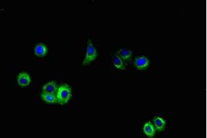 Immunofluorescent analysis of HepG2 cells using ABIN7144042 at dilution of 1:100 and Alexa Fluor 488-congugated AffiniPure Goat Anti-Rabbit IgG(H+L) (APP antibody  (AA 18-270))