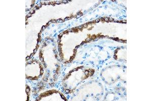 Immunohistochemistry of paraffin-embedded rat kidney using OAT Rabbit pAb (ABIN6127442, ABIN6144985, ABIN6144986 and ABIN6221831) at dilution of 1:150 (40x lens). (OAT antibody  (AA 160-439))