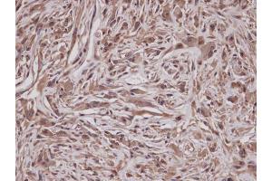 IHC-P Image Immunohistochemical analysis of paraffin-embedded U373 xenograft, using GRAP, antibody at 1:100 dilution. (GRAP antibody  (C-Term))