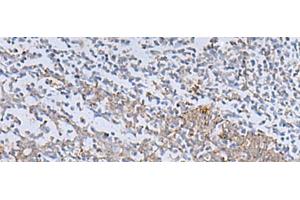 Immunohistochemistry of paraffin-embedded Human tonsil tissue using IL22RA2 Polyclonal Antibody at dilution of 1:70(x200) (IL22RA2 antibody)