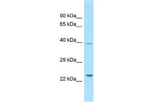 WB Suggested Anti-RAB7L1 Antibody Titration: 1. (RAB7L1 antibody  (C-Term))