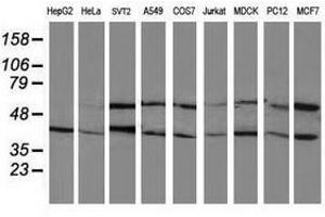 Image no. 2 for anti-Protein Phosphatase, Mg2+/Mn2+ Dependent, 1B (PPM1B) antibody (ABIN1500376) (PPM1B antibody)