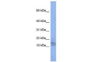 SPATA5 antibody used at 1 ug/ml to detect target protein. (SPATA5 antibody  (Middle Region))