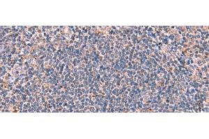 Immunohistochemistry of paraffin-embedded Human tonsil tissue using FDXR Polyclonal Antibody at dilution of 1:85(x200)