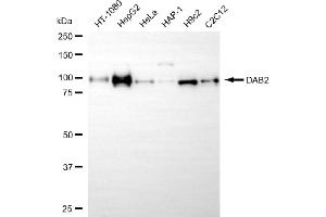 anti-Disabled Homolog 2, Mitogen-Responsive phosphoprotein (Drosophila) (DAB2) antibody