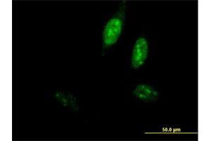 Immunofluorescence (IF) image for anti-Polymerase (DNA Directed), epsilon 3 (p17 Subunit) (POLE3) (AA 1-147) antibody (ABIN527026)