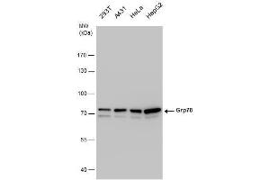 WB Image Grp78 antibody detects Grp78 protein by western blot analysis.