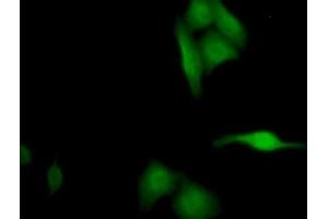 Detection of SEPT5 in Human HepG2 cell using Polyclonal Antibody to Septin 5 (SEPT5) (Septin 5 antibody  (AA 77-323))