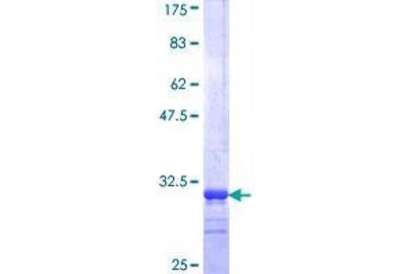 SLC13A5 Protein (AA 152-206) (GST tag)