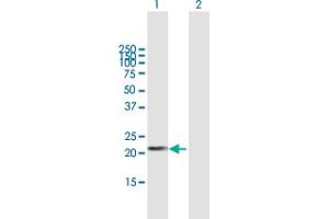 DHFRL1 antibody  (AA 1-187)