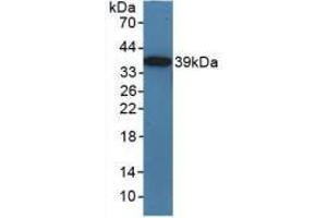 Figure. (TICAM1 antibody  (AA 263-526))