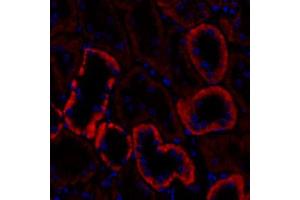 Immunofluorescent analysis of paraformaldehyde-fixed rat kidney using,Cadherin 16 (ABIN7073265) at dilution of 1: 1000 (Cadherin-16 antibody)