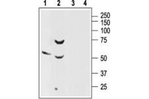 Western blot analysis of rat brain (lanes 1 and 3) and pancreas (lanes 2 and 4) lysates: - 1. (SSTR2 antibody  (Extracellular, N-Term))