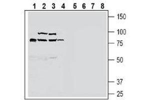 Western blot analysis of rat small intestine lysate (lanes 1 and 5), mouse liver lysate (lanes 2 and 6), rat liver lysate (lanes 3 and 7) and rat brain lysate (lanes 4 and 8): - 1-4. (SLC30A10 antibody  (C-Term, Intracellular))