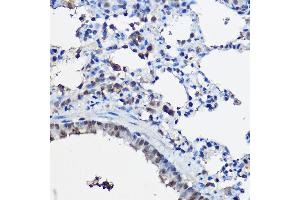 Immunohistochemistry (IHC) image for anti-Nuclear Receptor Coactivator 2 (NCOA2) (AA 550-820) antibody (ABIN6144413)