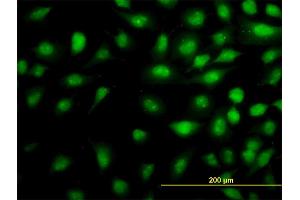 Immunofluorescence of monoclonal antibody to THRAP5 on HeLa cell. (MED16 antibody  (AA 1-110))