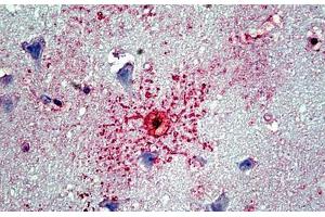 Human Cortex: Formalin-Fixed, Paraffin-Embedded (FFPE) (GFAP antibody)