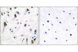 Immunohistochemistry analysis of paraffin-embedded human brain, using PYK2 (Phospho-Tyr580) Antibody. (PTK2B antibody  (pTyr580))