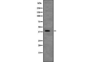 Western blot analysis of EIF2B2 expression in A431 whole cell lysate ,The lane on the left is treated with the antigen-specific peptide. (EIF2B2 antibody  (Internal Region))