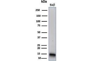 FABP5 antibody