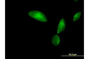 Immunofluorescence of purified MaxPab antibody to TMOD3 on HeLa cell.