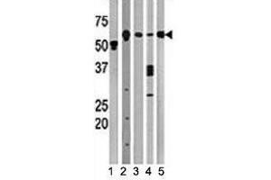 Western blot testing of Beclin antibody and (1) A2058, (2) HeLa, (3) mouse brain, (4) Y79, and (5) HL-60 lysate (Beclin 1 antibody  (AA 210-239))