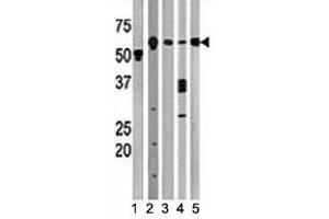 Western blot testing of Beclin antibody and (1) A2058, (2) HeLa, (3) mouse brain, (4) Y79, and (5) HL-60 lysate