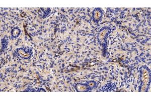 Immunohistochemistry (IHC) image for anti-Caveolin 1, Caveolae Protein, 22kDa (CAV1) (AA 2-104) antibody (ABIN7431320)