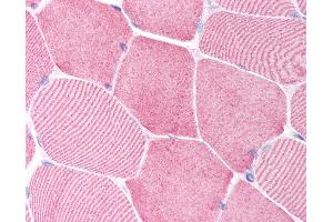 Anti-Caspase 6 antibody IHC of human skeletal muscle. (Caspase 6 antibody  (N-Term))