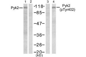 Western blot analysis of extract from Jurkat cells, untreated or treated with PMA (1ng/ml, 5min), using Pyk2 (Ab-402) antibody (E021209, Lane 1 and 2) and Pyk2 (phospho- Tyr402) antibody (E011216, Lane 3 and 4). (PTK2B antibody)