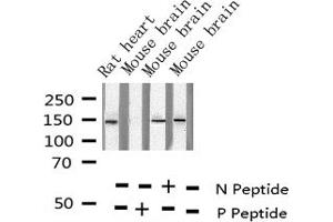Western blot analysis of Phospho-Met (Tyr1349) expression in various lysates (c-MET antibody  (pTyr1349))