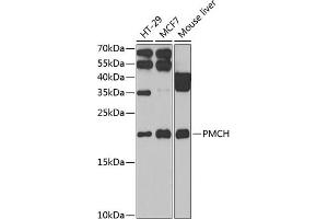 Western blot analysis of extracts of various cell lines, using PMCH antibody (ABIN6130564, ABIN6145812, ABIN6145813 and ABIN6222401) at 1:1000 dilution.