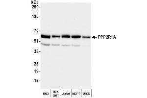 anti-Protein Phosphatase 2, Regulatory Subunit A, alpha (PPP2R1A) (C-Term) antibody